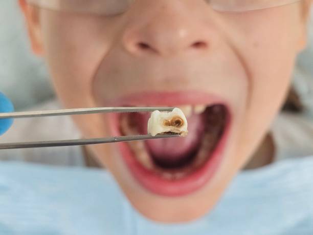 Best Pediatric Emergency Dentist in Kremmling, CO